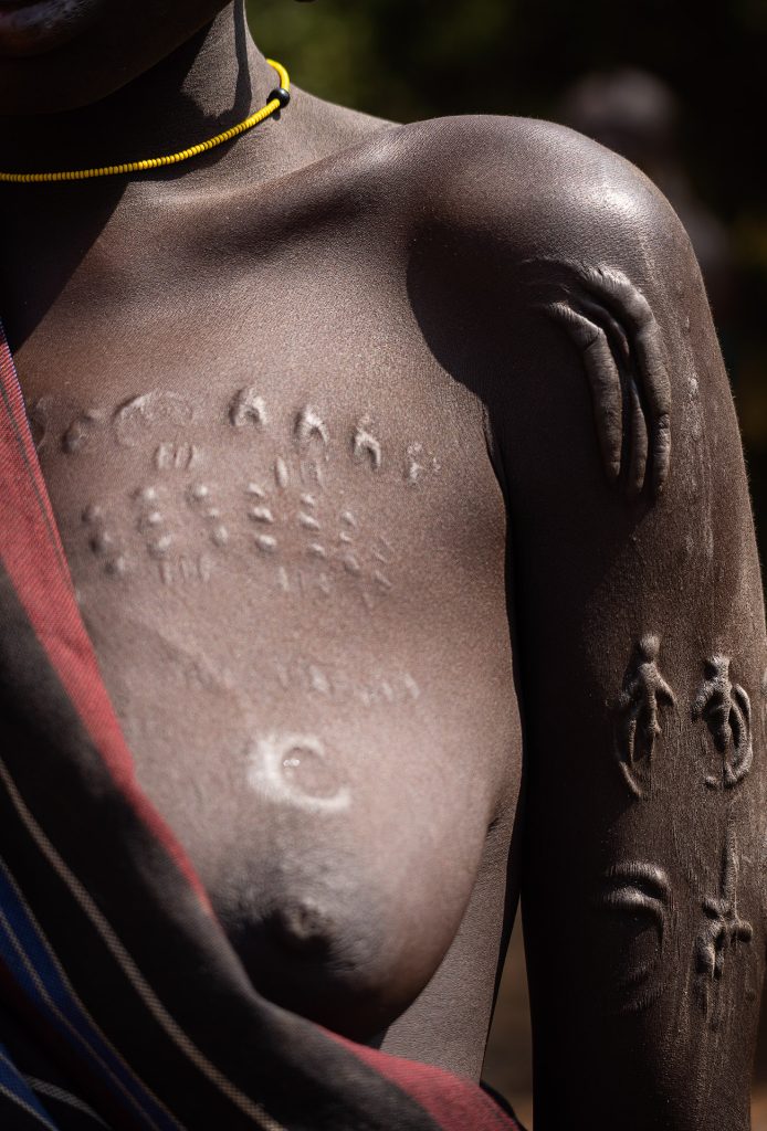 Ausschnitt des linken Arms und der entblößten Brust einer Mursi mit dekorativen Schmucknarben. Der Arm ist im Licht, die Brust ist verschwommen, und über die linke Seite ist ein Tuch gelegt.